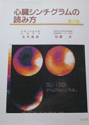 心臓シンチグラムの読み方 玉木 長良; 加藤 洋