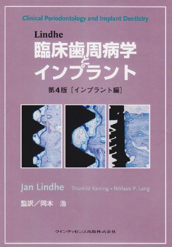 Lindhe 臨床歯周病学とインプラント 第4版[インプラント編] Jan Lindhe、 Thorkild Karring、 Niklaus P. Lang; 岡本 浩