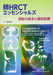 肺HRCTエッセンシャルズ 読影の基本と鑑別診断 高橋雅士