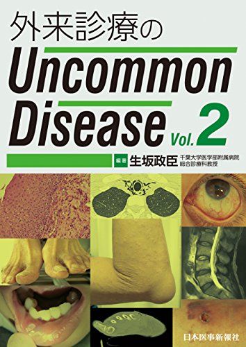 外来診療のUncommon Disease 単行本 生坂 政臣