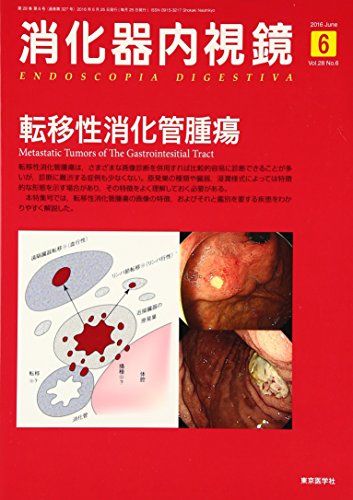 【30日間返品保証】商品説明に誤りがある場合は、無条件で弊社送料負担で商品到着後30日間返品を承ります。【最短翌日到着】正午12時まで（日曜日は午前9時まで）の注文は当日発送（土日祝も発送）。関東・関西・中部・中国・四国・九州地方は翌日お届け、東北地方・新潟県・北海道・沖縄県は翌々日にお届けします。【インボイス制度対応済み】当社ではインボイス制度に対応した適格請求書発行事業者番号（通称：T番号・登録番号）を印字した納品書（明細書）を商品に同梱してお送りしております。こちらをご利用いただくことで、税務申告時や確定申告時に消費税額控除を受けることが可能になります。また、適格請求書発行事業者番号の入った領収書・請求書をご注文履歴からダウンロードしていただくこともできます（宛名はご希望のものを入力していただけます）。ご満足のいく取引となるよう精一杯対応させていただきます。※下記に商品説明およびコンディション詳細、出荷予定・配送方法・お届けまでの期間について記載しています。ご確認の上ご購入ください。■商品名■消化器内視鏡第28巻6号 転移性消化管腫瘍 消化器内視鏡編集委員会■出版社■東京医学社■著者■消化器内視鏡編集委員会■発行年■2016/06/27■ISBN10■4885634857■ISBN13■9784885634857■コンディションランク■可コンディションランク説明ほぼ新品：未使用に近い状態の商品非常に良い：傷や汚れが少なくきれいな状態の商品良い：多少の傷や汚れがあるが、概ね良好な状態の商品(中古品として並の状態の商品)可：傷や汚れが目立つものの、使用には問題ない状態の商品■コンディション詳細■書き込みありません。記名や蔵書印があるため可としております。その他概ね良好。記名・蔵書印以外は良のコンディション相当の商品です。水濡れ防止梱包の上、迅速丁寧に発送させていただきます。【発送予定日について】正午12時まで（日曜日は午前9時まで）のご注文は当日に発送いたします。正午12時（日曜日は午前9時）以降のご注文は翌日に発送いたします（土曜日・日曜日・祝日も発送しています）。※土曜日・祝日も正午12時までのご注文は当日に発送いたします。※年末年始（12/31〜1/3）は除きます。(例)・月曜0時〜12時までのご注文：月曜日に発送・月曜12時〜24時までのご注文：火曜日に発送・土曜0時〜12時までのご注文：土曜日に発送・土曜12時〜24時のご注文：日曜日に発送・日曜0時〜9時までのご注文：日曜日に発送・日曜9時〜24時のご注文：月曜日に発送【送付方法について】ネコポス、宅配便またはレターパックでの発送となります。東北地方・新潟県・北海道・沖縄県・離島以外は、発送翌日に到着します。東北地方・新潟県・北海道・沖縄県・離島は、発送後2日での到着となります。商品説明と著しく異なる点があった場合や異なる商品が届いた場合は、到着後30日間は無条件で着払いでご返品後に返金させていただきます。メールまたはご注文履歴からご連絡ください。