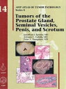 Tumors of the Prostate Gland，Seminal Vesicles，Penis，and Scrotum (AFIP Atlas of Tumor Pathology: Series 4) Epstein，Jonathan