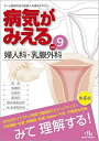 病気がみえる vol.9 婦人科 乳腺外科 単行本 医療情報科学研究所