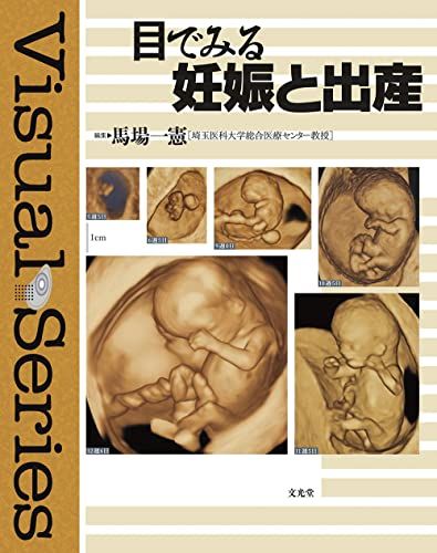 【30日間返品保証】商品説明に誤りがある場合は、無条件で弊社送料負担で商品到着後30日間返品を承ります。ご満足のいく取引となるよう精一杯対応させていただきます。※下記に商品説明およびコンディション詳細、出荷予定・配送方法・お届けまでの期間について記載しています。ご確認の上ご購入ください。【インボイス制度対応済み】当社ではインボイス制度に対応した適格請求書発行事業者番号（通称：T番号・登録番号）を印字した納品書（明細書）を商品に同梱してお送りしております。こちらをご利用いただくことで、税務申告時や確定申告時に消費税額控除を受けることが可能になります。また、適格請求書発行事業者番号の入った領収書・請求書をご注文履歴からダウンロードして頂くこともできます（宛名はご希望のものを入力して頂けます）。■商品名■目でみる妊娠と出産 (Visual series) [大型本] 一憲，馬場■出版社■文光堂■著者■一憲 馬場■発行年■2013/10/05■ISBN10■4830631228■ISBN13■9784830631221■コンディションランク■良いコンディションランク説明ほぼ新品：未使用に近い状態の商品非常に良い：傷や汚れが少なくきれいな状態の商品良い：多少の傷や汚れがあるが、概ね良好な状態の商品(中古品として並の状態の商品)可：傷や汚れが目立つものの、使用には問題ない状態の商品■コンディション詳細■書き込みありません。古本のため多少の使用感やスレ・キズ・傷みなどあることもございますが全体的に概ね良好な状態です。水濡れ防止梱包の上、迅速丁寧に発送させていただきます。【発送予定日について】こちらの商品は午前9時までのご注文は当日に発送致します。午前9時以降のご注文は翌日に発送致します。※日曜日・年末年始（12/31〜1/3）は除きます（日曜日・年末年始は発送休業日です。祝日は発送しています）。(例)・月曜0時〜9時までのご注文：月曜日に発送・月曜9時〜24時までのご注文：火曜日に発送・土曜0時〜9時までのご注文：土曜日に発送・土曜9時〜24時のご注文：月曜日に発送・日曜0時〜9時までのご注文：月曜日に発送・日曜9時〜24時のご注文：月曜日に発送【送付方法について】ネコポス、宅配便またはレターパックでの発送となります。関東地方・東北地方・新潟県・北海道・沖縄県・離島以外は、発送翌日に到着します。関東地方・東北地方・新潟県・北海道・沖縄県・離島は、発送後2日での到着となります。商品説明と著しく異なる点があった場合や異なる商品が届いた場合は、到着後30日間は無条件で着払いでご返品後に返金させていただきます。メールまたはご注文履歴からご連絡ください。