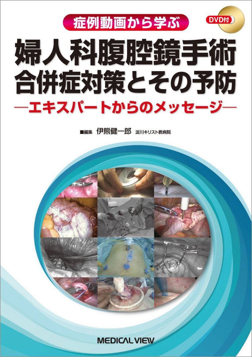 楽天市場】動画で学ぶ婦人科腹腔鏡手術トレーニングの通販