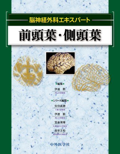 前頭葉・側頭葉 (脳神経外科エキスパート) [大型本] 勲，伊達