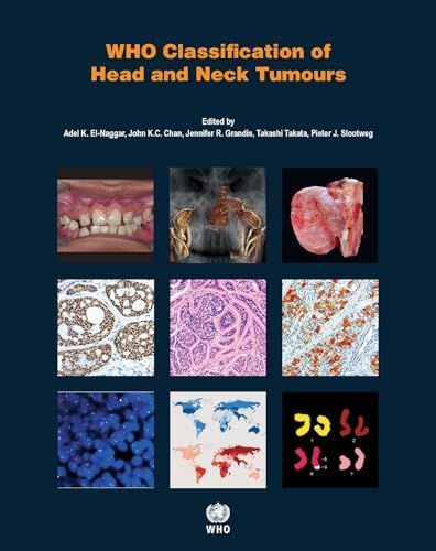 WHO Classification of Head and Neck Tumours (World Health Organization Classification of Tumours) [ペーパーバック] El-naggar， Adel K.、