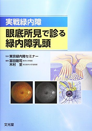 実戦緑内障 眼底所見で診る緑内障乳頭 [単行本] 東京緑内障セミナー、 剛司，富田; 至，木村