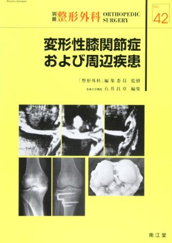 変形性膝関節症および周辺疾患 (別冊整形外科) 「整形外科」編集委員; 良章，石井