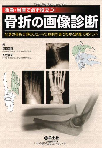 救急・当直で必ず役立つ!骨折の画像診断―全身の骨折分類のシェーマと症例写真でわかる読影のポ  福田 国彦; 丸毛 啓史