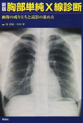 新版胸部単純X線診断―画像の成り立ちと読影の進め方  林 邦昭; 中田 肇