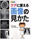 ケアに使える画像の見かた X線写真・CT画像・エコー像・MRI/久志本成樹【3000円以上送料無料】