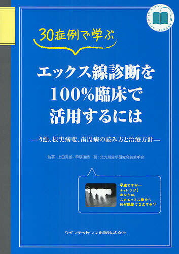 30症例で学ぶエックス線診断を100%臨床で活用するには う蝕、根尖病変、歯周病の読み方と治療方針【3000円以上送料無料】