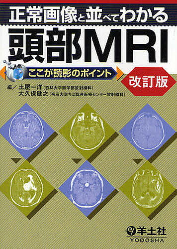 正常画像と並べてわかる頭部MRI／土屋一洋／大久保敏之【3000円以上送料無料】