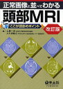 正常画像と並べてわかる頭部MRI/土屋一洋/大久保敏之【3000円以上送料無料】