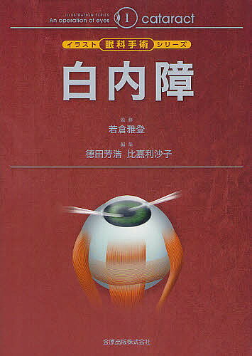 白内障／若倉雅登／徳田芳浩／比嘉利沙子【3000円以上送料無料】のサムネイル