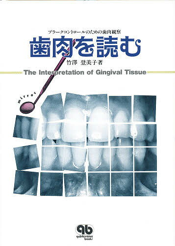 楽天bookfan 1号店 楽天市場店歯肉を読む プラークコントロールのための歯肉観察／竹沢登美子【3000円以上送料無料】