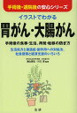 イラストでわかる胃がん・大腸がん 手術後の食事・生活、再発・転移の防ぎ方 生活処方と後遺症・副作用への対処法、社会復帰と経済支援のいろいろ/浦山雅弘/川口清【3...