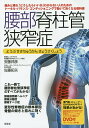 腰部脊柱管狭窄症 トータル・バランス・コンディショニングで動いて良くなる教科書 腰部脊柱管狭窄症のすべてがわかる 患者様とご家族が読む本/安藤邦彦/佐藤拓矢【3...