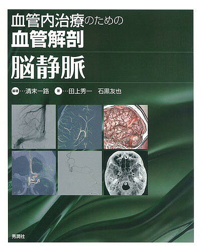 血管内治療のための血管解剖脳静脈／清末一路／田上秀一／石黒友也【3000円以上送料無料】