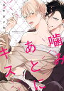 噛みあとにキス/あまきいお【3000円以上送料無料】