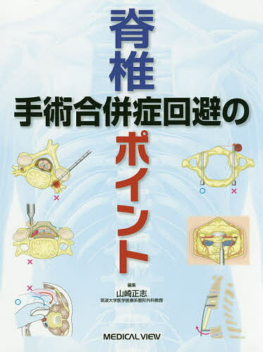 脊椎手術合併症回避のポイント／山崎正志【3000円以上送料無料】