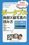 本当は教わりたかったポータブル胸部X線写真の読み方 サクッとよめて,ガツンとわかる7日間特別講義／松本純一／細井康太郎／松本純一【3000円以上送料無料】