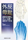 外反母趾 病態を理解し,正しい治療選択ができる/須田康文【3000円以上送料無料】