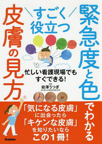 すごく役立つ緊急度と色でわかる皮膚の見方 忙しい看護現場でもすぐできる!／岩澤うつぎ【3000円以上送..