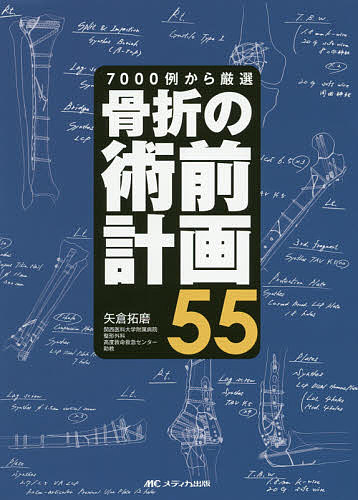 骨折の術前計画55 7000例から厳選／矢倉拓磨【3000円以上送料無料】