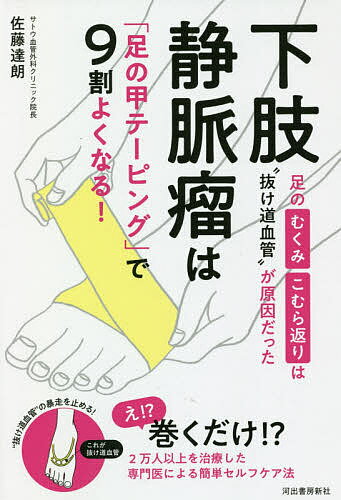 下肢静脈瘤は「足の甲テーピング」で9割よくなる! 足のむくみ・こむら返りは“抜け道血管”が原因だった／佐藤達朗