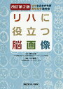 リハに役立つ脳画像 コツさえわかればあなたも読める/大村優慈/酒向正春【3000円以上送料無料】