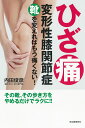 ひざ痛変形性膝関節症 靴を変えればもう痛くない!/内田俊彦【3000円以上送料無料】(3)