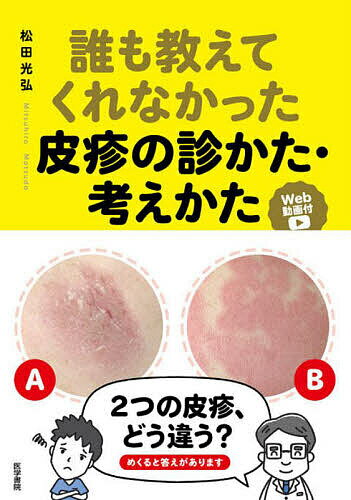 誰も教えてくれなかった皮疹の診かた・考えかた Web動画付／松田光弘【3000円以上送料無料】