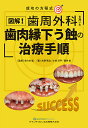 図解!歯周外科を用いた歯肉縁下う蝕の治療手順 成功の方程式/佐々木猛/水野秀治/小谷洋平【3000円以上送料無料】