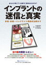 インプラントの迷信と真実 診査・診断〜インプラント周囲炎治療まで/中居伸行/大月基弘【3000円以上送料無料】