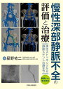 慢性深部静脈不全の評価と治療 弾性ストッキングから静脈ステント治療まで/星野祐二【3000円以上送料無料】