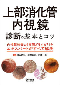 上部消化管内視鏡診断の基本とコツ 内視鏡検査の「実際どうする?」をエキスパートがすべて解決/滝沢耕平/濱本英剛/市原真【3000円以上送料無料】