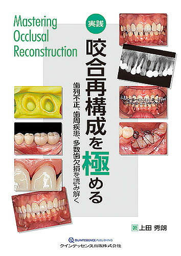実践咬合再構成を極める 歯列不正、歯周疾患、多数歯欠損を読み解く／上田秀朗【3000円以上送料無料】
