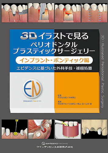楽天市場】ペリオドンタルプラスティックサージェリーの通販 楽天市場】ペリオドンタルプラスティックサージェリーの通販