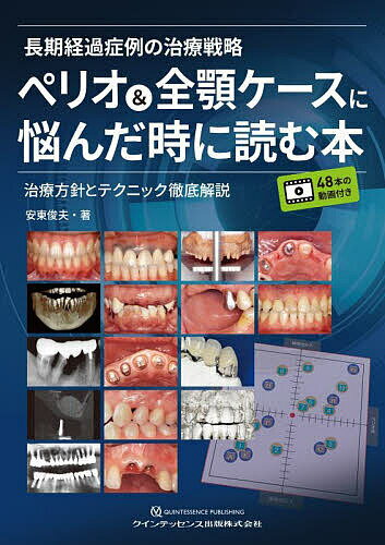 長期経過症例の治療戦略ペリオ&全顎ケースに悩んだ時に読む本 治療方針とテクニック徹底解説／安東俊夫