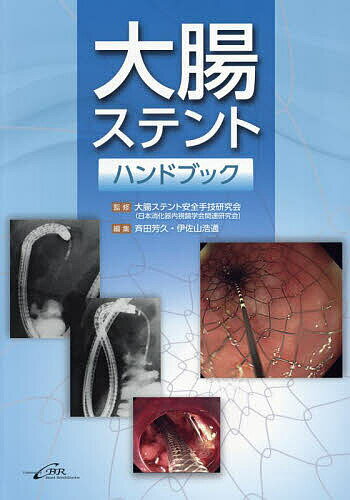 大腸ステントハンドブック／大腸ステント安全手技研究会（日本消化器内視鏡学会関連研究会）／斉田芳久／伊佐山浩通【3000円以上送料無料】