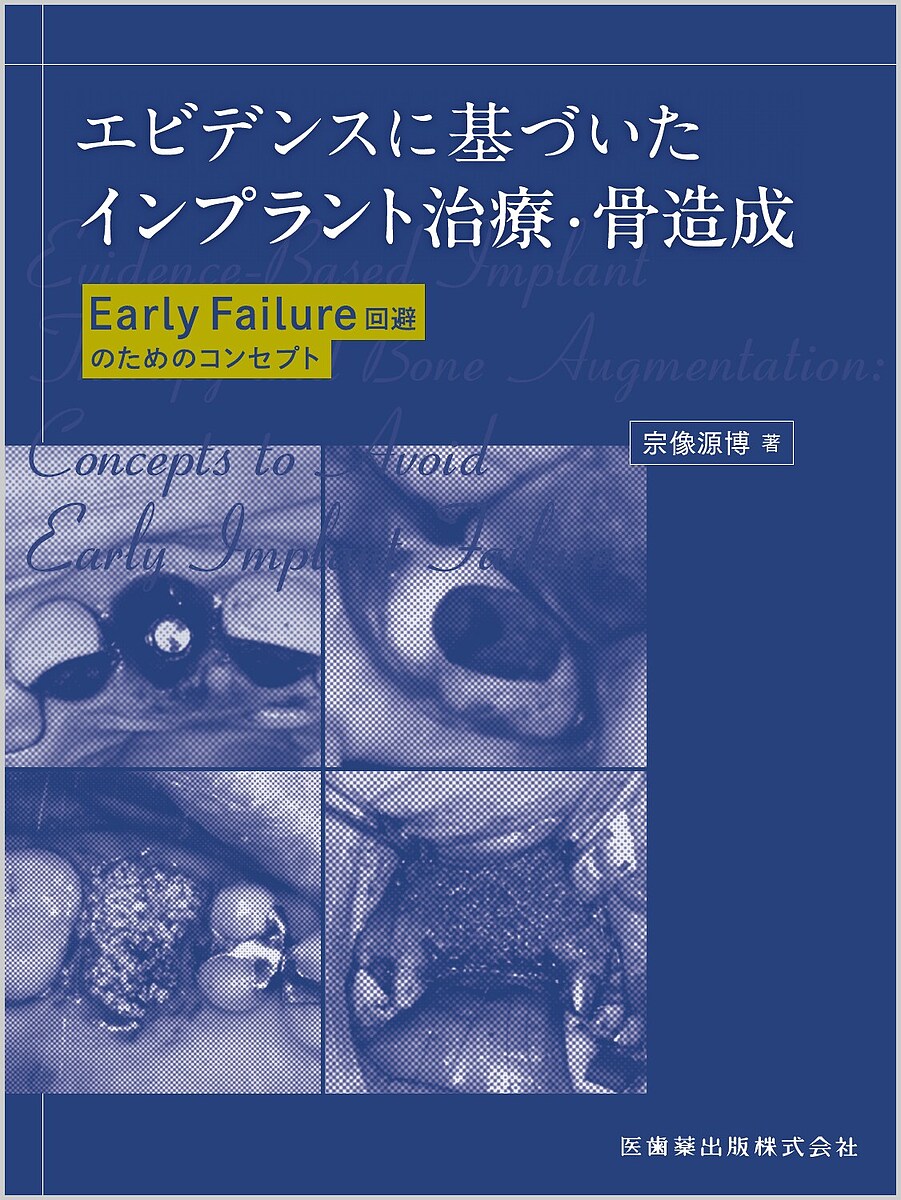 エビデンスに基づいたインプラント治療・骨造成 Early Failure回避のためのコンセプト／宗像源博【3000円以上送料無料】