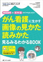 がん看護に生かす画像の見かた読みかた見るみるわかるBOOK 検査説明&前・中・後のケアもばっちり!/松本勝/結束貴臣【3000円以上送料無料】