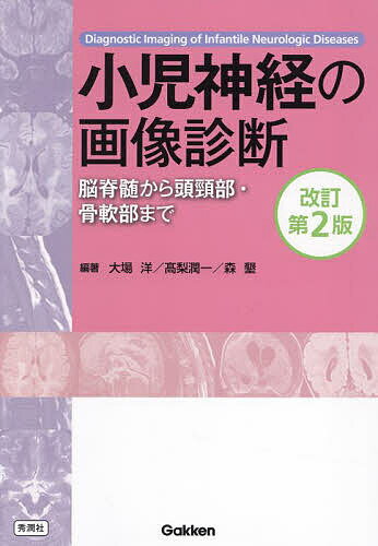著者大場洋(編著) 高梨潤一(編著) 森墾(編著)出版社Gakken発売日2024年04月ISBN9784055200547ページ数935Pキーワードしようにしんけいのがぞうしんだんのうせきずい シヨウニシンケイノガゾウシンダンノウセキズイ おおば ひろし たかなし じゆ オオバ ヒロシ タカナシ ジユ9784055200547内容紹介発生・病理から先天代謝・腫瘍、脊髄・頭頸部・骨軟部の疾患まで、日常診療に役立つ様々な疾患を、豊富な画像とあわせて丁寧に解説。改訂版では疾患概念の変化、遺伝子バリアントの関わりなど新しい知見を取り入れた。小児神経領域の画像診断に必携の1冊。Contents［総論］1．脳脊髄の発生・発達2．神経病理3．磁気共鳴画像4．超音波検査・CT・血管造影・脳血流SPECT・骨単純X線診断5．造影剤6．遺伝子異常症［各論］1．骨系統疾患・奇形症候群の頭蓋骨・脊椎単純写真所見2．神経発生異常3．水頭症4．新生児・周産期異常5．頭部外傷6．脳血管障害7．小児・若年梗塞8．感染症9．急性脳症・脳炎10．先天代謝疾患11．脱髄性・薬剤性・中毒性疾患12．てんかん13．神経皮膚症候群（母斑症）14．腫瘍および腫瘍様病変15．下垂体・傍鞍部疾患16．脊髄・脊椎疾患17．眼窩・側頭骨18．頭頸部19．骨軟部※本データはこの商品が発売された時点の情報です。目次総論（脳脊髄の発生・発達/神経病理/磁気共鳴画像/超音波検査・CT・血管造影・脳血流SPECT・骨単純X線診断/造影剤/遺伝子異常）/各論（骨系統疾患・奇形症候群の頭蓋骨・脊椎単純写真所見/神経発生異常/水頭症/新生児・周産期異常/頭部外傷 ほか）