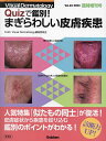 Quizで鑑別!まぎらわしい皮膚疾患/VisualDermatology編集委員会【3000円以上送料無料】