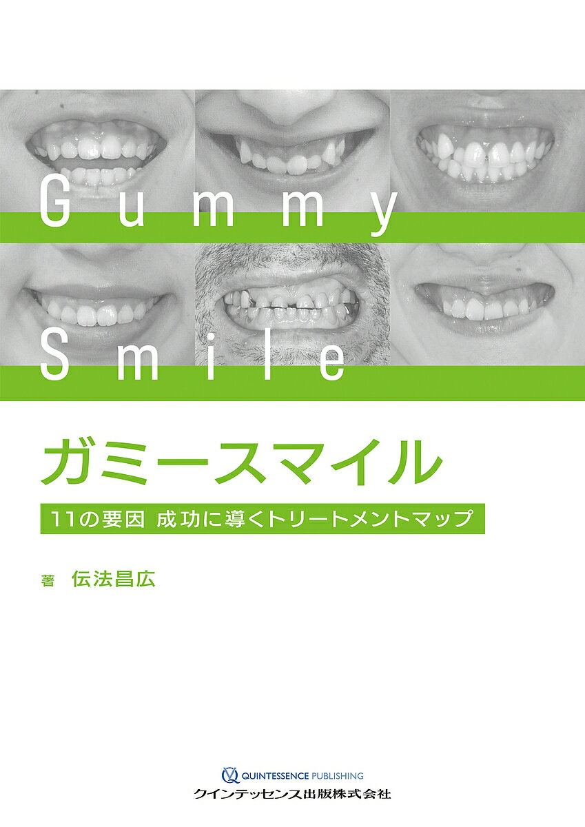 ガミースマイル 11の要因成功に導くトリートメントマップ／伝法昌広【3000円以上送料無料】