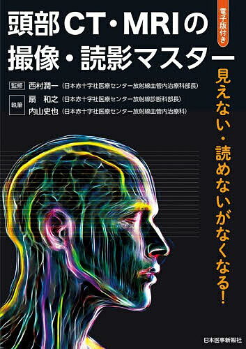 頭部CT・MRIの撮像・読影マスター 見えない・読めないがなくなる!／西村潤一／扇和之／内山史也【3000円以上送料無料】