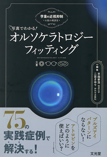 【新品】オルソケラトロジー レンズ関連セット 楽天市場】オルソケラトロジーレンズ（コンタクトレンズ・ケア