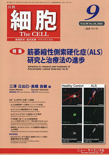 ※商品画像はイメージや仮デザインが含まれている場合があります。帯の有無など実際と異なる場合があります。出版社ニュー・サイエンス社発売日2026年08月24日JAN4912041270969雑誌版型A4キーワードさいぼう サイボウ4912041270969内容紹介筋萎縮性側索硬化症（ALS）研究と治療法の進歩※本データはこの商品が発売された時点の情報です。